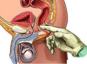 procedure