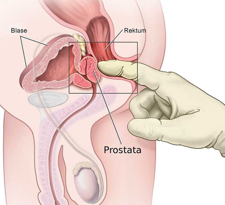 Prostate massage for prostate